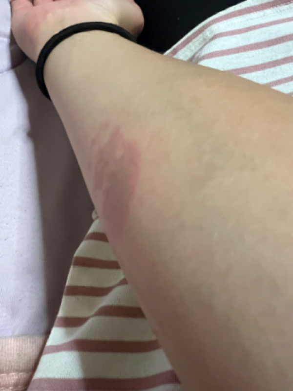 優しいひとづま くみ　【ヘルスコース】 ピェン