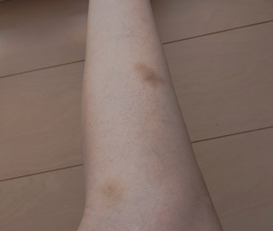 道後トレビの泉 結城　こはく☆溢れ出るエロス あざアザ